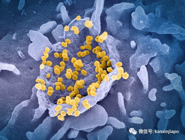 今增3112 | 半数康复者一年半内面临二次感染威胁！手把手带你预约免费科兴