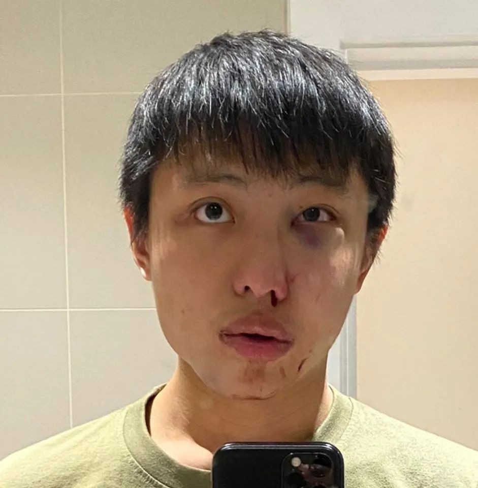 为“新冠病毒”回头,新加坡留学生在伦敦街头遭群殴!